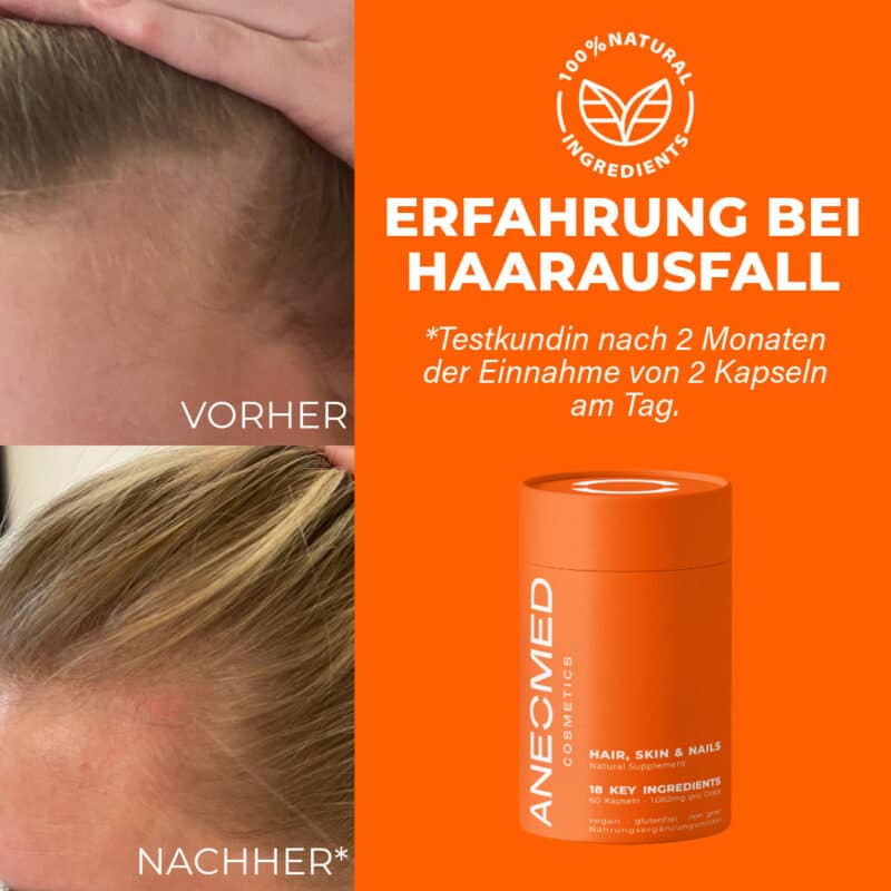 ANEOMED Cosmetics 18 in 1 Haut Haare Nägel Kapseln Haarkapseln vegan Nahrungsergänzungsmittel natürlich Haarausfall Geheimratsecken was hilft